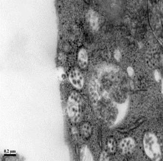 EM of Chikungunya virus-infected human muscle cells ~ A/Prof Justin Chu, Department of Microbiology and Immunology, NUS