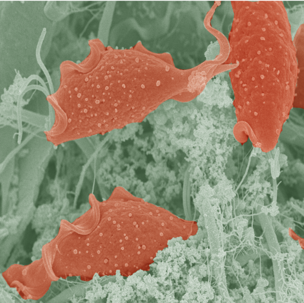 Trichomonas mouse gut infection
(red parasites with a whip-like tail)
~ Dr. Benoit Malleret, Electron Microscopy Unit, NUS Medicine