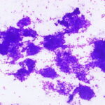 Figure 1: Hemacolor 10x